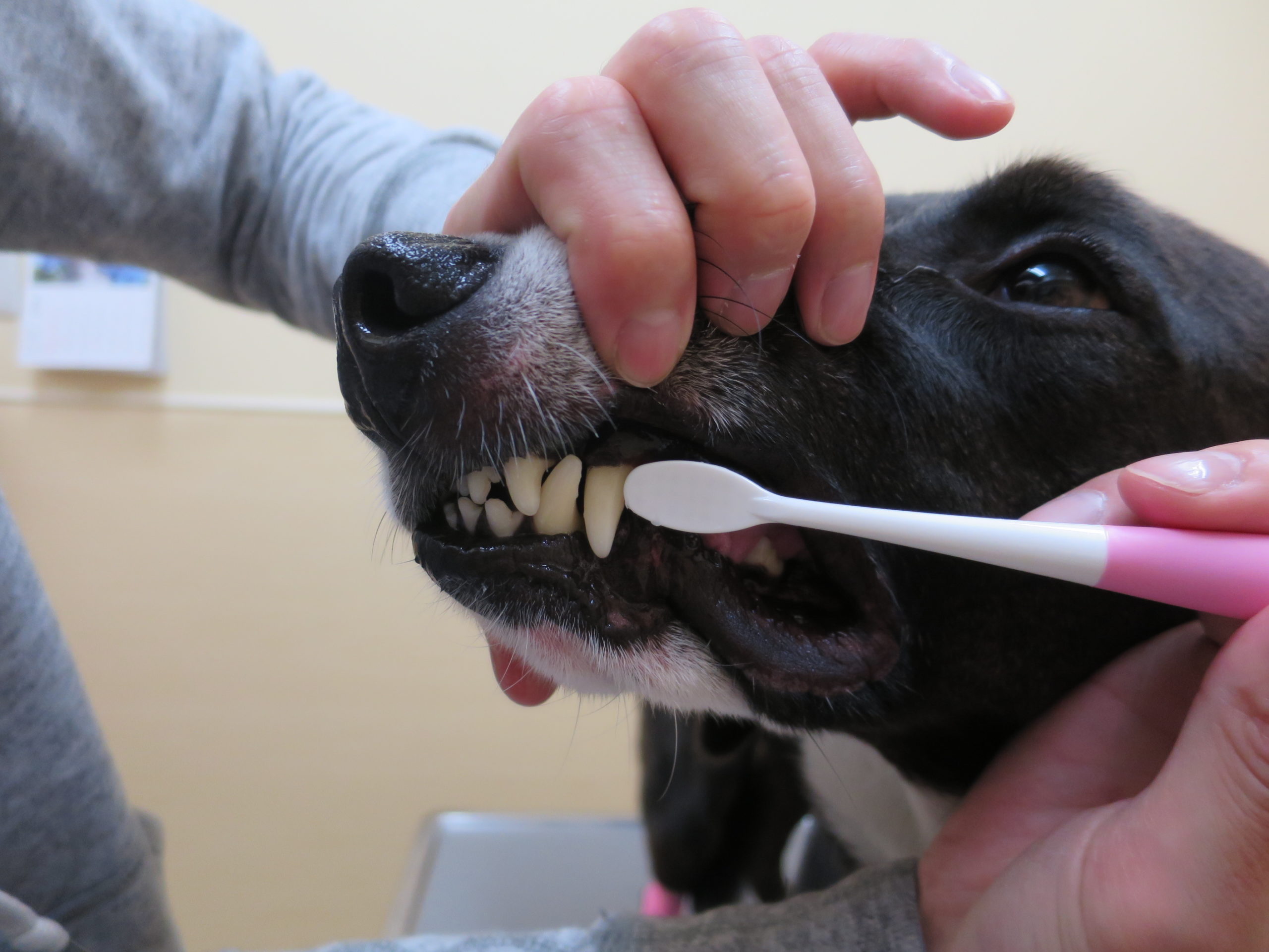 歯の側面をブラッシングします。